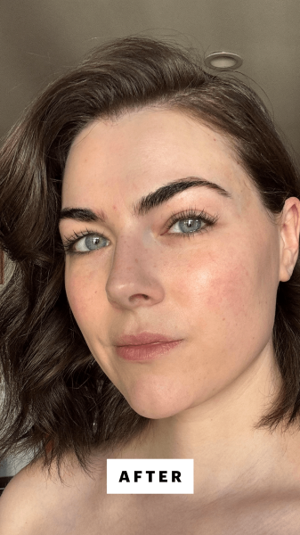 DallAsen after using the Head Shoulders Classic Clean