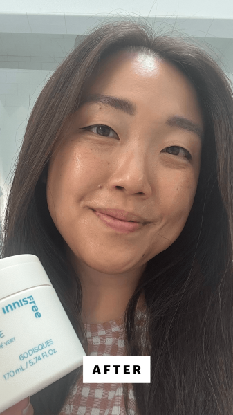 Lee after applying Innisfree Gentle Retinol Salicylic Daily Toner Pads